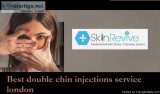 double chin injections Skin Revive