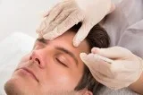 Micrograft De La Ceja  Kaloni Hair