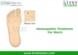 Homeopathy health tips for Warts