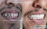 Start Loving Your Smile With A Smile Makeover