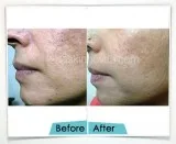 Aesthetic Treatment in Gurgaon