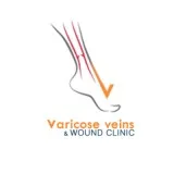 Varicose Vein Laser Treatment by Dr. Chandrakant S Kamble