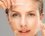 Chemical peels treatment in banashankari