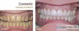 Dental Bridges in Brockville