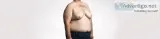 Best Gynecomastia Surgery at the clinic of Aestiva in Delhi