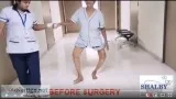 Best Knee Replacement Surgery Hospital in Ahmedabad