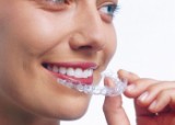 Teeth Braces For Kids  Dental Clinic