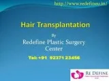Hair Transplantation In Hyderabad  Hair Transplant Cost
