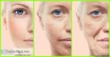 Psoriasis Treatments Chandigarh