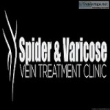Laser Vein Removal Centers