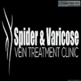 Laser Vein Removal Centers
