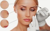 Mesotherapy in Toronto