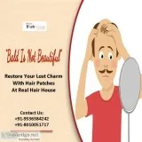 Non Surgical Hair Replacement