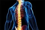 Spinal Hosipital Delhi - capri Spine