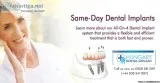 Get Immediate Dental Implants &ndash Same Day Teeth or Teeth in 