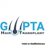 Top Class Hair Transplant in Ludhiana