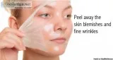 No More Acne scars - Berkowits Advance Chemical Peel Treatment