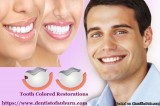 Tooth Colored Restorations Wa  Teeth Whitening Dentistry in Aubu