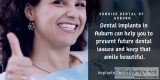 Implants Dentistry in Auburn wa  Teeth whitening dentistry Aubur