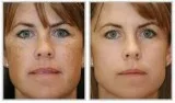 Best Dermatologist in Madinaguda  Best Skin Doctor in Hyderabad 