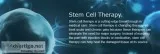 Stem Cell Treatment Houston - Sugar land functional Medicine