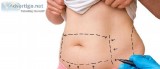 Get Rid Of Your Stubborn Fats. Get This Liposuction Surgery in M