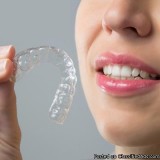 Best Orthodontic Treatment In Gurgaon - Punyam Dental