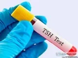 Need to Book TSH Test Learn More View Cost Book Online Get Resul