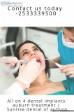 Affordable Dental Services  All On 4 Dental Implants Auburn  Sun