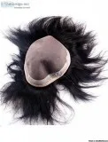 Hairwala.com - hair patch treatment in Rajkot