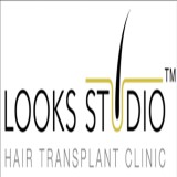 Affordable Hair Transplant in Bangalore.