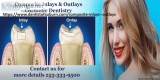 Cosmetic Dentistry Wa - Composite Inlays andamp Outlays  Sunrise