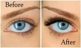 Hair loss treatment Toronto  Facial  Toronto