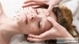 GEt The Best Acupuncture Services in Vaughan