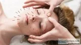 GEt The Best Acupuncture Services in Vaughan