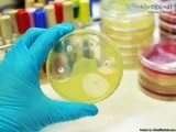 Urine Culture Testing and Sensitivity Test in HyderabadDelhi - B