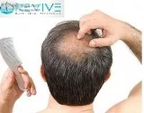 Hair Loss Medication