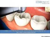 Best Orthodontist In Chennai