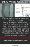 USA Vein Clinics