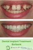 Best Dentists for All Dental Services in Burbank