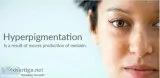Best ointment for hyperpigmentation