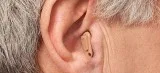 What is the ear hearing machine price in India