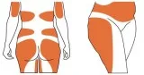 Liposuction Surgery Cost In Delhi Best Liposuction Surgeon In De