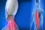 Treatment Options for Osteoporosis