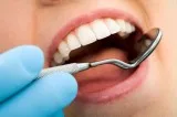 Dental Cleaning (regular and deep) X-rays sealants