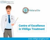 Best Vitiligo treatment center in india Melanosite.