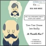 Hair Patch in Delhi