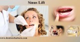 Affordable Tooth Implants Auburn  Best dentist in Auburn  Sinus 