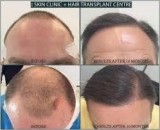 Uk s Top Hair and Skin Specialist - Revive Hair and Skin Clinic