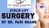 Eyelid Lift Surgery By Dr. Pari Shams